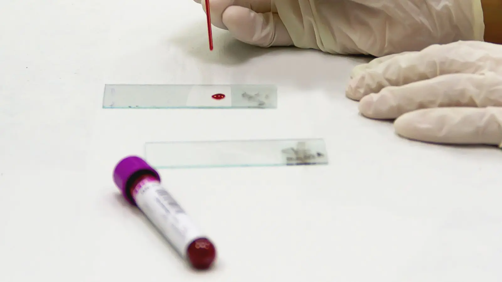 Gloved hands over a glass slide with a drop of blood, next to a lab sample tube with a purple cap.